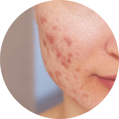 Condition Image - Miderma