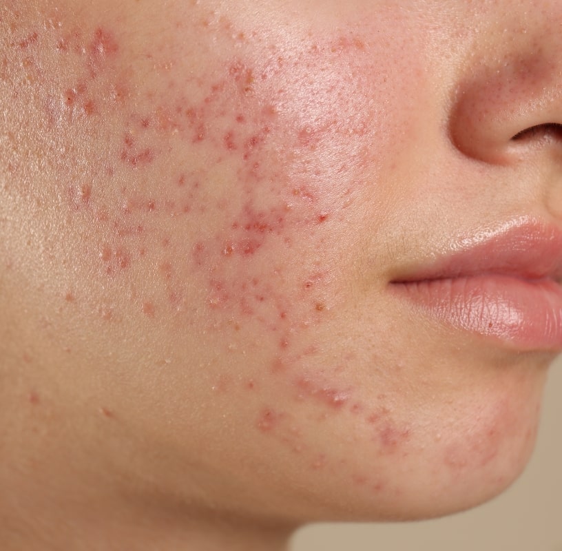 Condition Category - Miderma