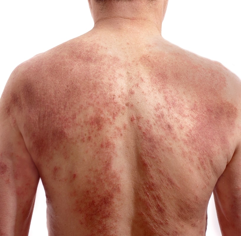 Condition Category - Miderma