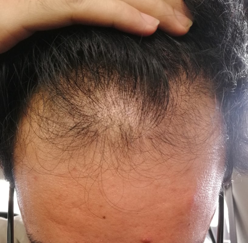 Condition Category - Miderma