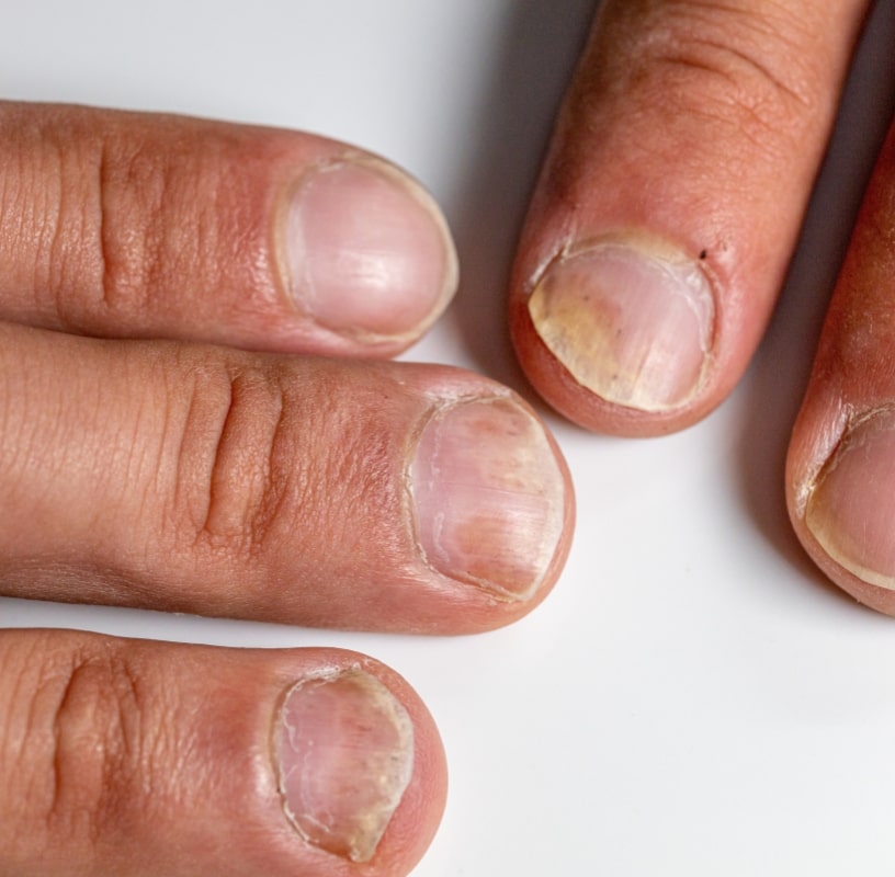 Condition Category - Miderma