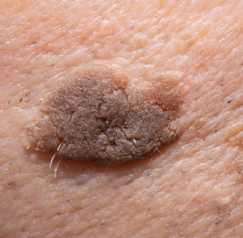 Condition Category - Miderma