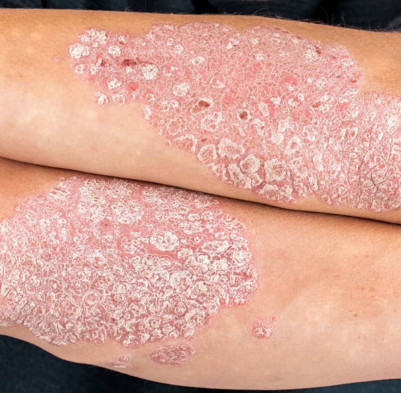 Condition Category - Miderma