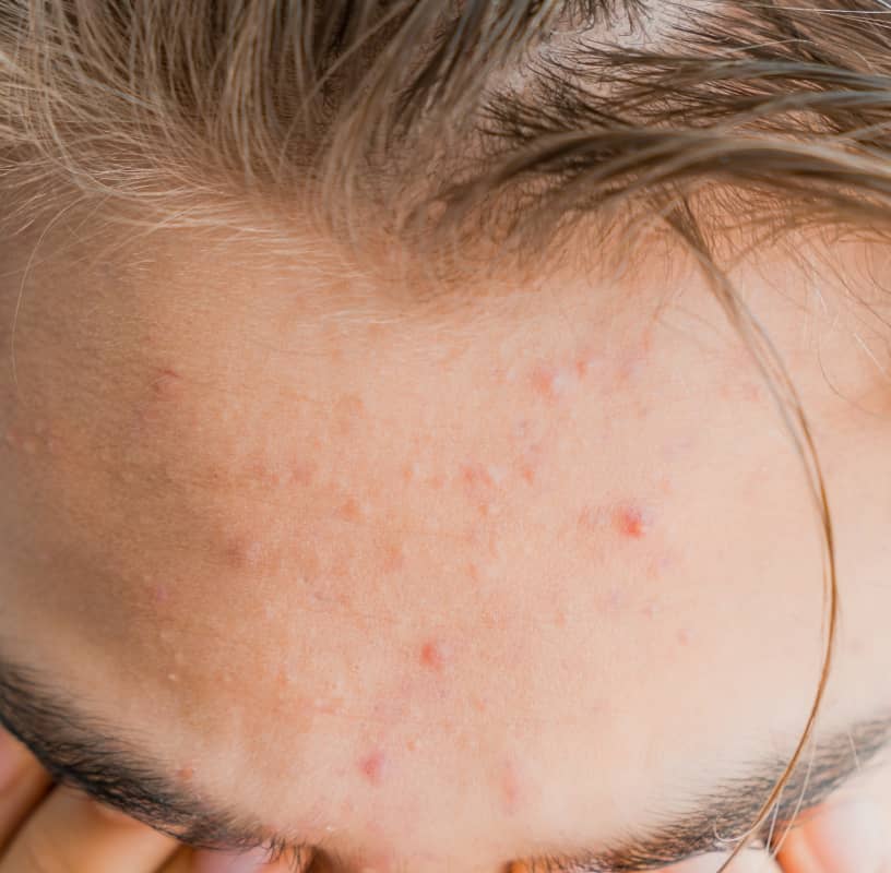 Condition Category - Miderma