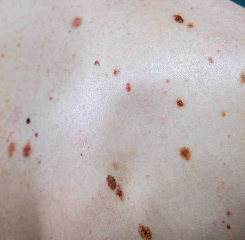 Condition Category - Miderma