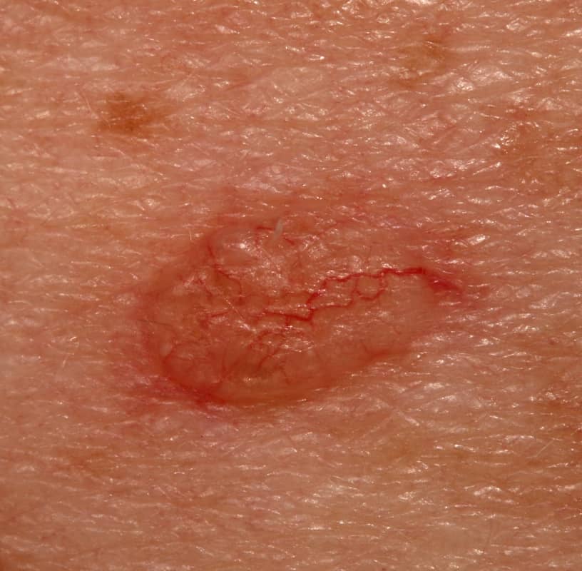 Condition Category - Miderma