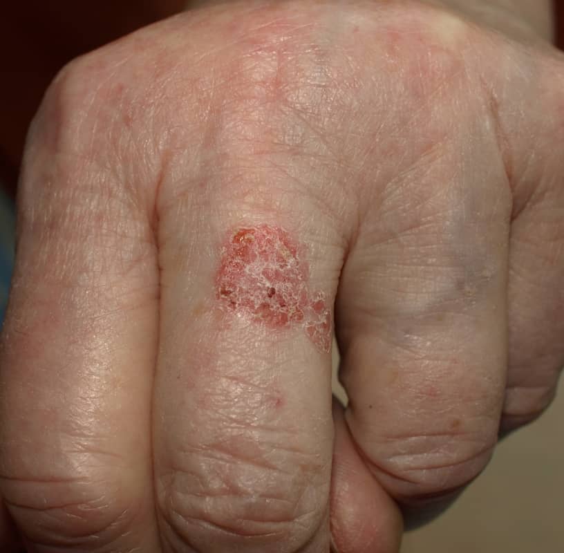 Condition Category - Miderma