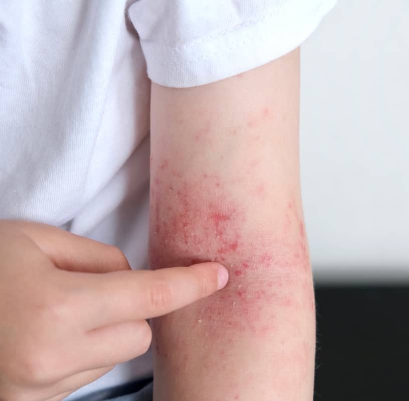 Condition Category - Miderma