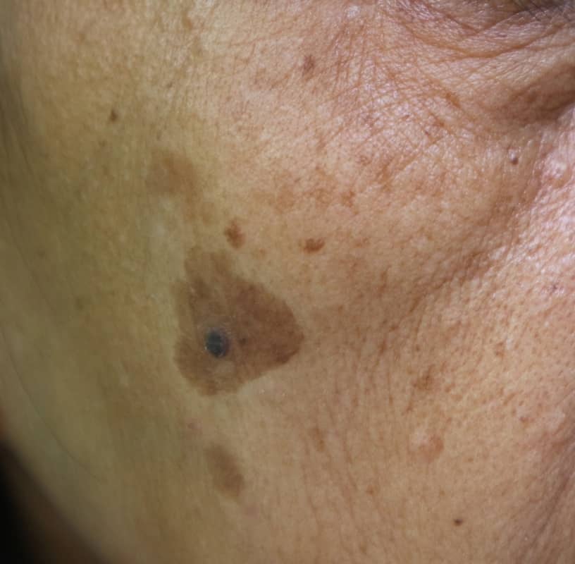 Condition Category - Miderma