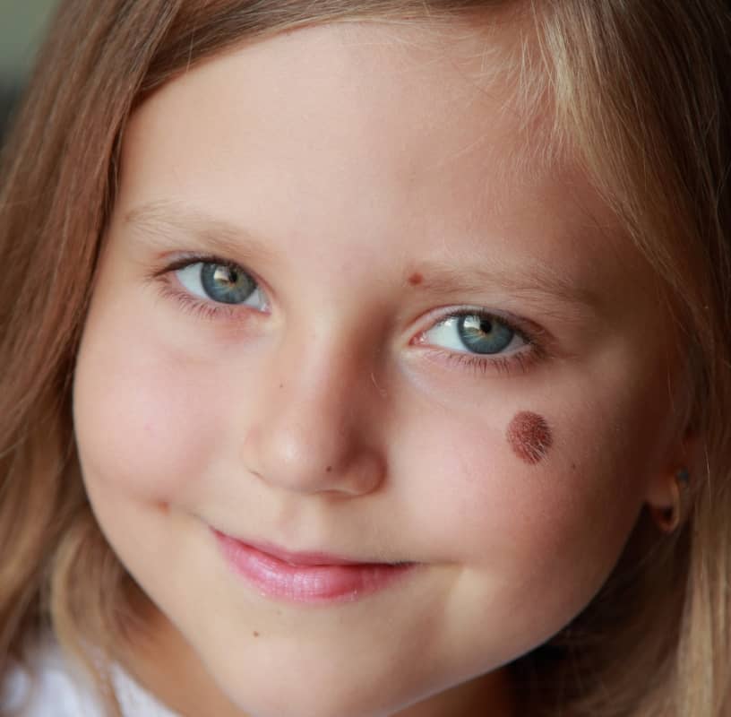 Condition Category - Miderma