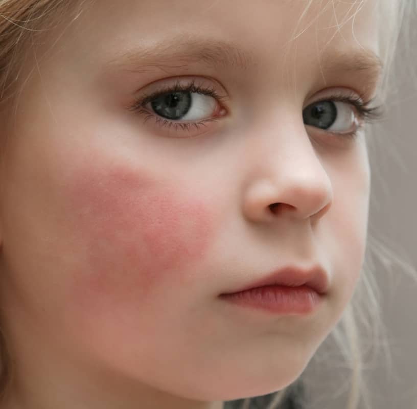 Condition Category - Miderma