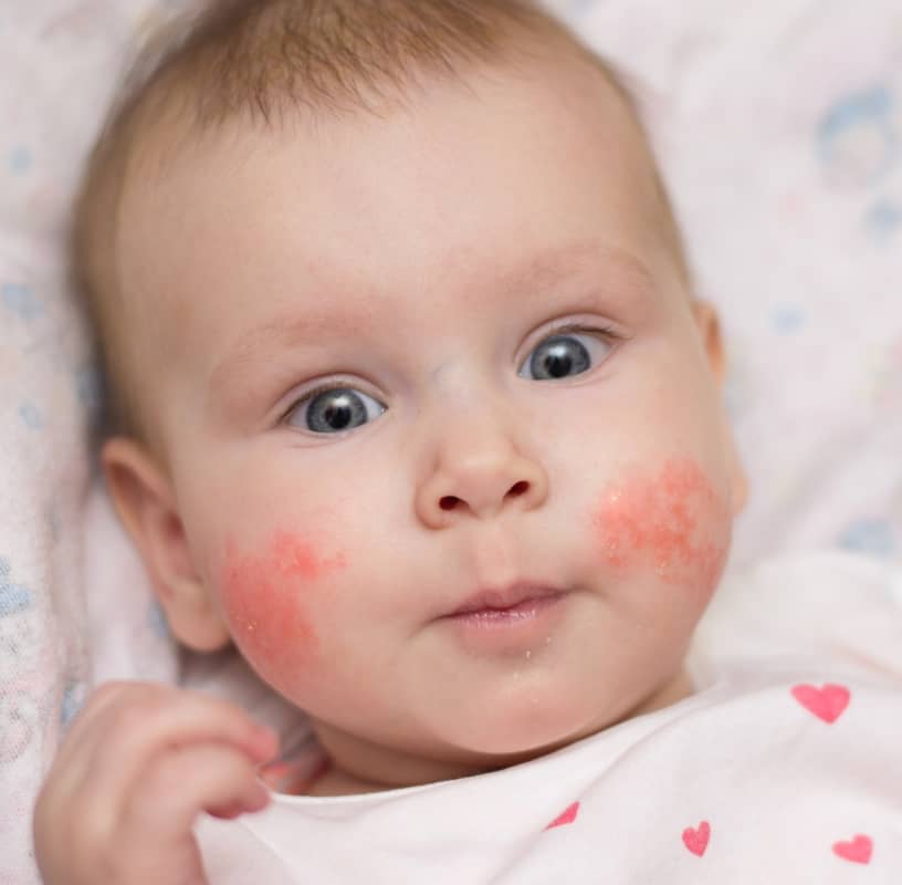 Condition Category - Miderma