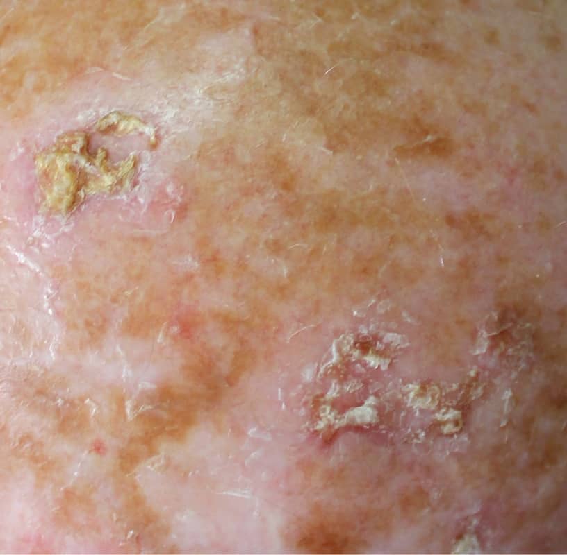 Condition Category - Miderma