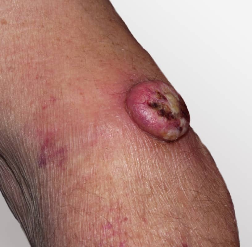 Condition Category - Miderma