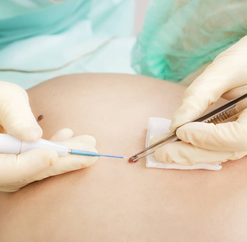 Condition Category - Miderma